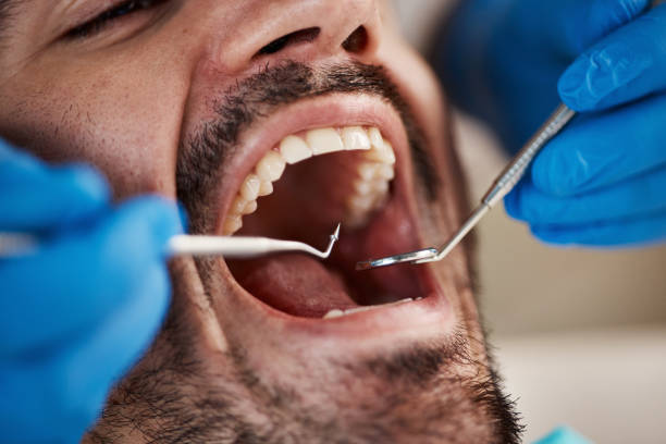 Best Emergency Dentist for Special Needs Patients in Shepherd, MI