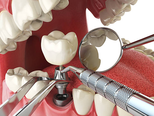 Best Emergency Cosmetic Dentistry in Shepherd, MI